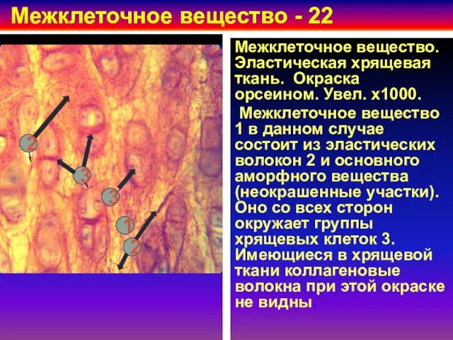 Межклеточное вещество - 22 Межклеточное вещество. Эластическая хрящевая ткань. Окраска орсеином.