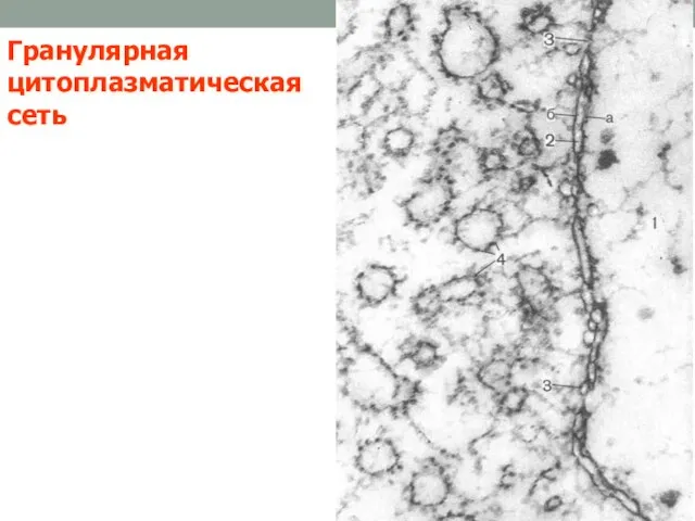 Гранулярная цитоплазматическая сеть