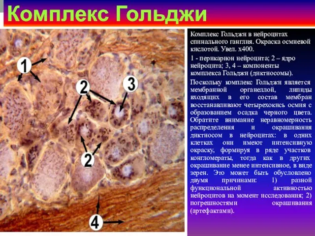 Комплекс Гольджи Комплекс Гольджи в нейроцитах спинального ганглия. Окраска осмиевой кислотой.