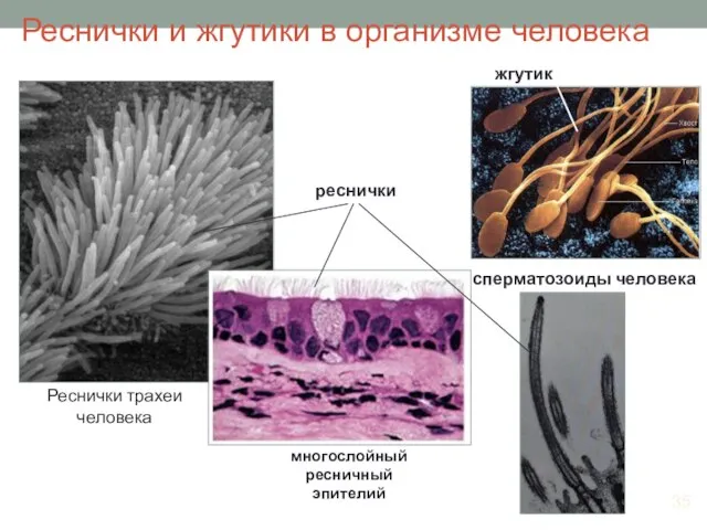 Реснички и жгутики в организме человека сперматозоиды человека жгутик реснички многослойный