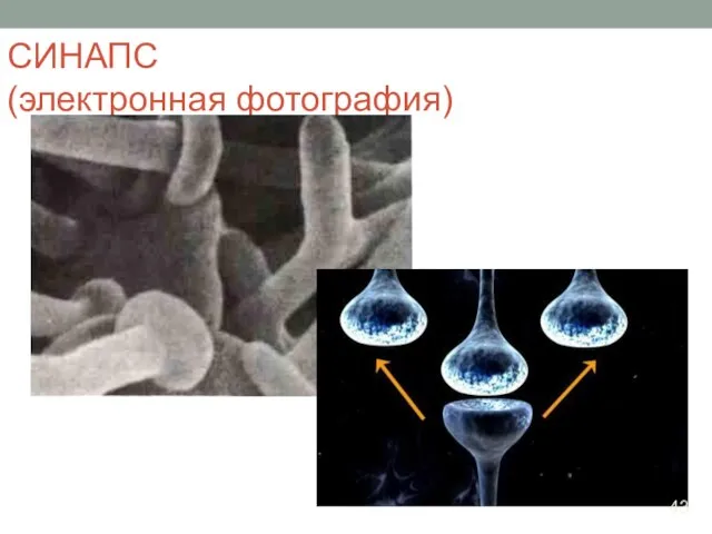 СИНАПС (электронная фотография) 43