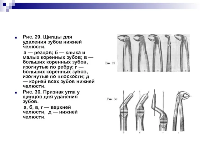 Рис. 29. Щипцы для удаления зубов нижней челюсти. а — резцов;