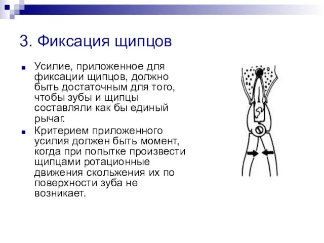 3. Фиксация щипцов Усилие, приложенное для фиксации щипцов, должно быть достаточным