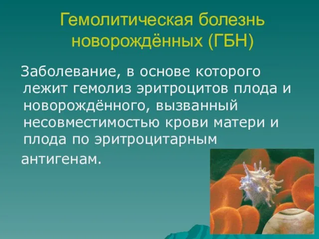 Гемолитическая болезнь новорождённых (ГБН) Заболевание, в основе которого лежит гемолиз эритроцитов