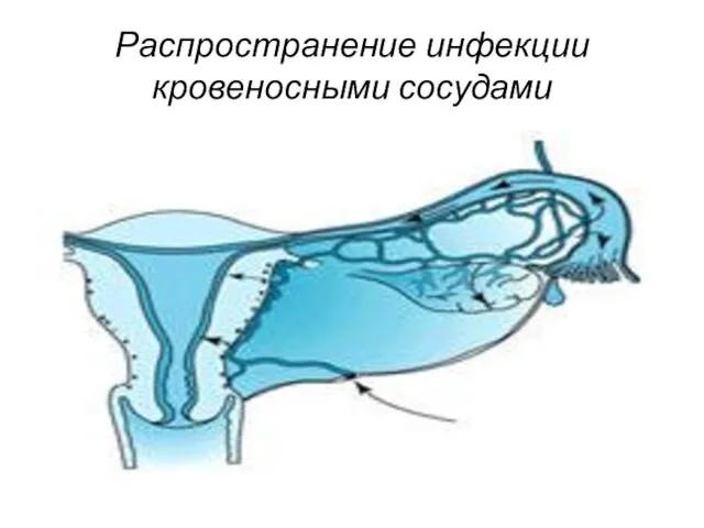 Распространение инфекции кровеносными сосудами