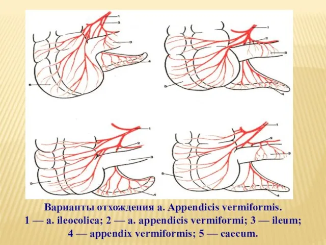 Варианты отхождения a. Appendicis vermiformis. 1 — a. ileocolica; 2 —