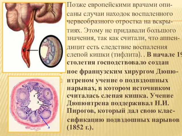 Позже европейскими врачами опи- саны случаи находок воспаленного червеобразного отростка на