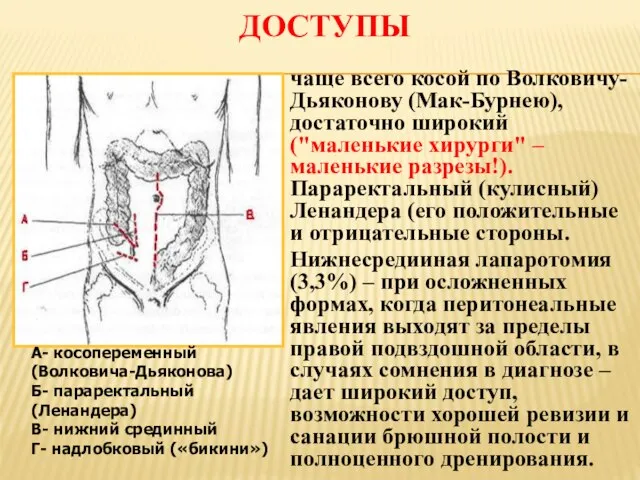 ДОСТУПЫ чаще всего косой по Волковичу-Дьяконову (Мак-Бурнею), достаточно широкий ("маленькие хирурги"