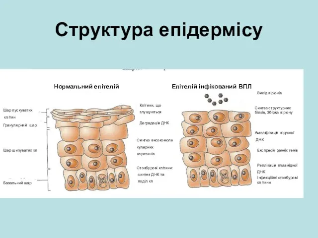 Структура епідермісу Нормальний епітелій Епітелій інфікований ВПЛ Шар лускуватих клітин Гранулярний