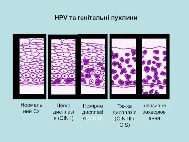 HPV та генітальні пухлини