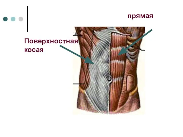 прямая Поверхностная косая