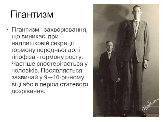 Гігантизм - захворювання, що виникає при надлишковій секреції гормону передньої долі