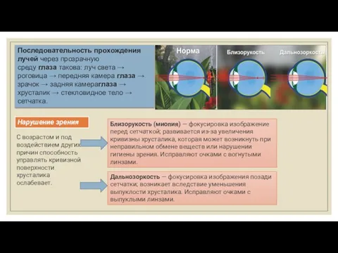 Последовательность прохождения лучей через прозрачную среду глаза такова: луч света →