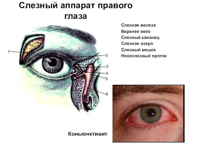 Слезный аппарат правого глаза Слезная железа Верхнее веко Слезный каналец Слезное