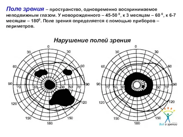 Нарушение полей зрения (скотомы) Поле зрения – пространство, одновременно воспринимаемое неподвижным