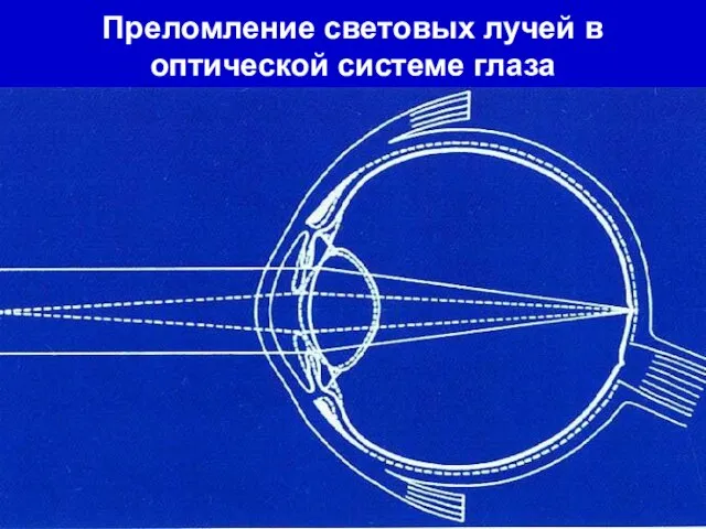 Преломление световых лучей в оптической системе глаза