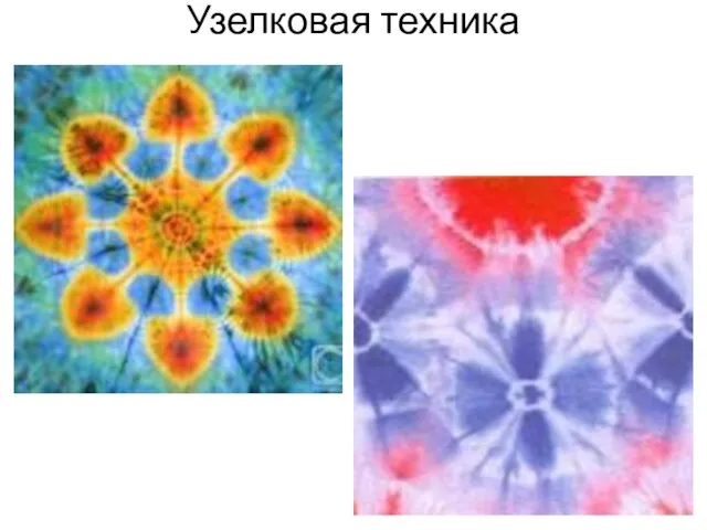 Узелковая техника