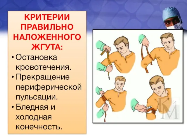 КРИТЕРИИ ПРАВИЛЬНО НАЛОЖЕННОГО ЖГУТА: Остановка кровотечения. Прекращение периферической пульсации. Бледная и холодная конечность.