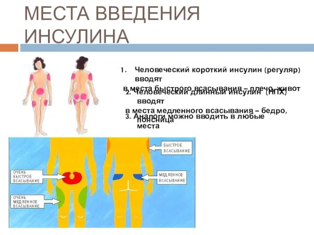 МЕСТА ВВЕДЕНИЯ ИНСУЛИНА Человеческий короткий инсулин (регуляр) вводят в места быстрого