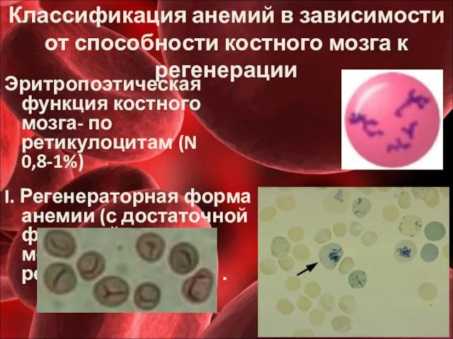 Классификация анемий в зависимости от способности костного мозга к регенерации Эритропоэтическая