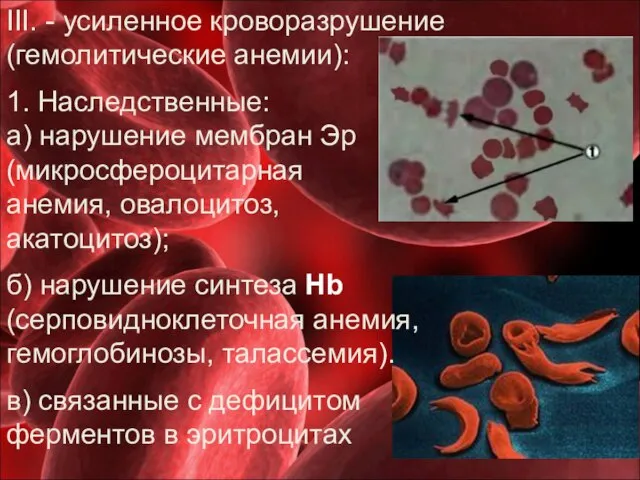 III. - усиленное кроворазрушение (гемолитические анемии): 1. Наследственные: а) нарушение мембран