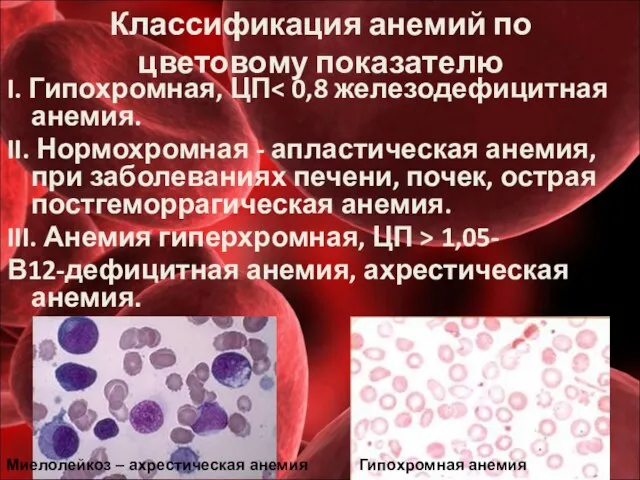 Классификация анемий по цветовому показателю I. Гипохромная, ЦП II. Нормохромная -