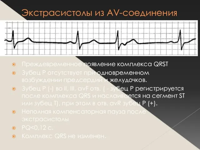 Экстрасистолы из AV-соединения Преждевременное появление комплекса QRST Зубец Р отсутствует при