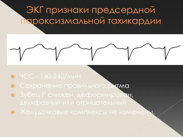 ЭКГ признаки предсердной пароксизмальной тахикардии ЧСС - 140-240/мин Сохранение правильного ритма