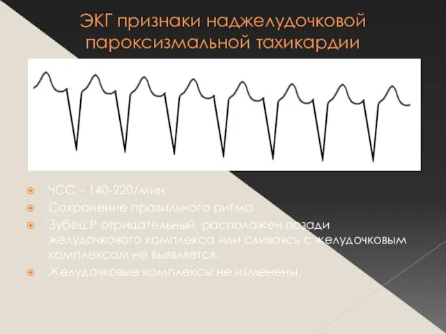 ЭКГ признаки наджелудочковой пароксизмальной тахикардии ЧСС – 140-220/мин Сохранение правильного ритма