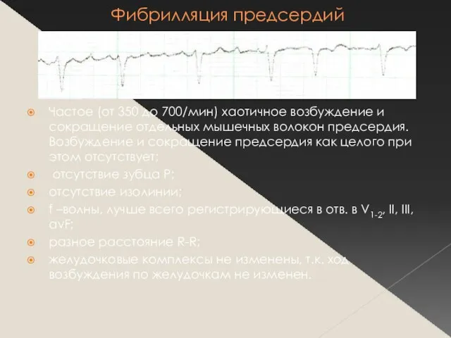 Фибрилляция предсердий Частое (от 350 до 700/мин) хаотичное возбуждение и сокращение