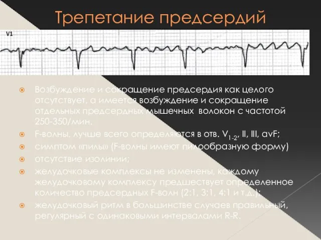 Трепетание предсердий Возбуждение и сокращение предсердия как целого отсутствует, а имеется