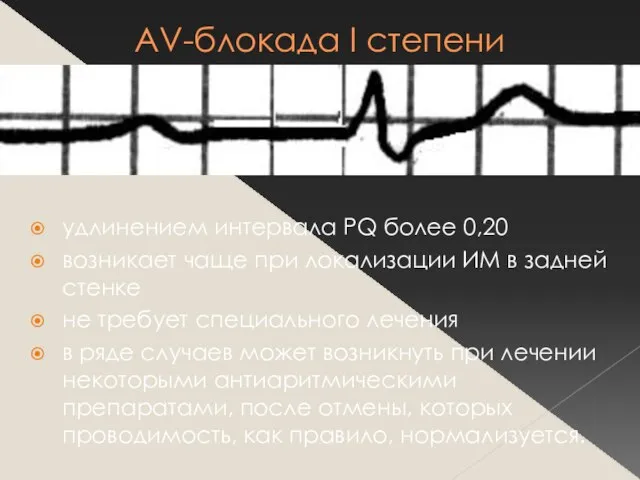 АV-блокада I степени удлинением интервала PQ более 0,20 возникает чаще при