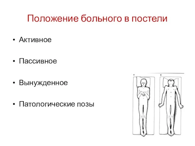 Положение больного в постели Активное Пассивное Вынужденное Патологические позы