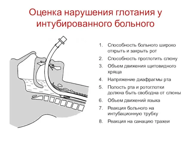 Оценка нарушения глотания у интубированного больного Cпособность больного широко открыть и