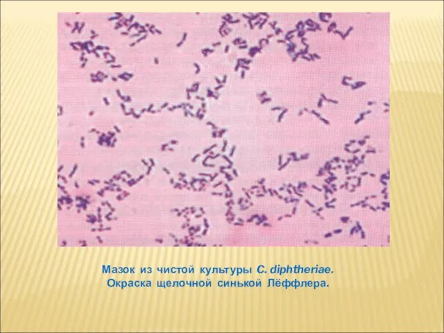 Мазок из чистой культуры C. diphtheriae. Окраска щелочной синькой Лёффлера.