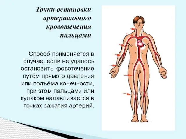 Точки остановки артериального кровотечения пальцами Способ применяется в случае, если не