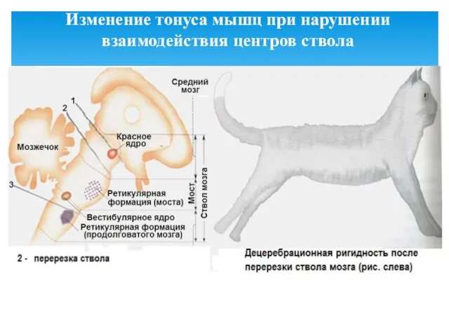 Изменение тонуса мышц при нарушении взаимодействия центров ствола