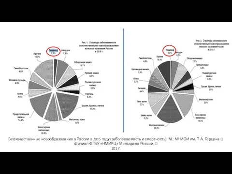 Злокачественные новообразования в России в 2015 году (заболеваемость и смертность). М.: