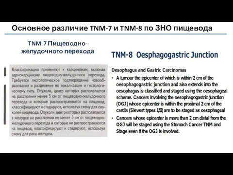 Основное различие TNM-7 и TNM-8 по ЗНО пищевода TNM-7 Пищеводно-желудочного перехода