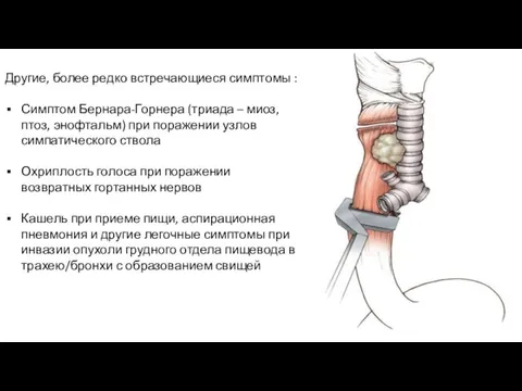 Другие, более редко встречающиеся симптомы : Симптом Бернара-Горнера (триада – миоз,