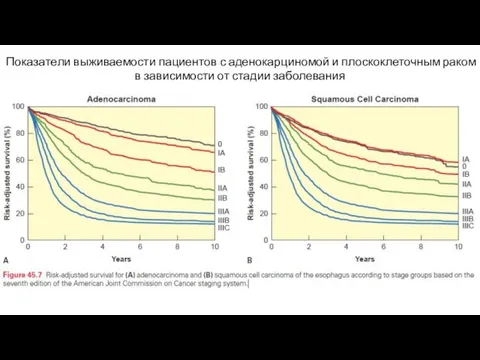 Показатели выживаемости пациентов с аденокарциномой и плоскоклеточным раком в зависимости от стадии заболевания