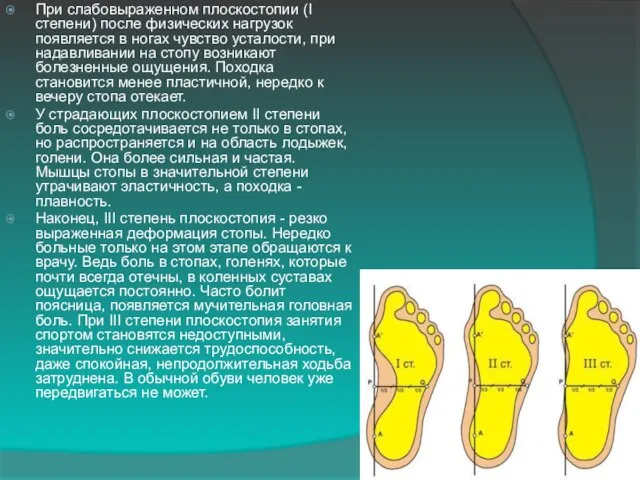 При слабовыраженном плоскостопии (I степени) после физических нагрузок появляется в ногах