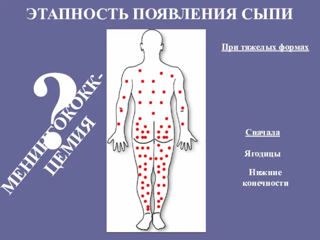 Ягодицы ? МЕНИНГОКОКК-ЦЕМИЯ Нижние конечности Сначала При тяжелых формах ЭТАПНОСТЬ ПОЯВЛЕНИЯ СЫПИ