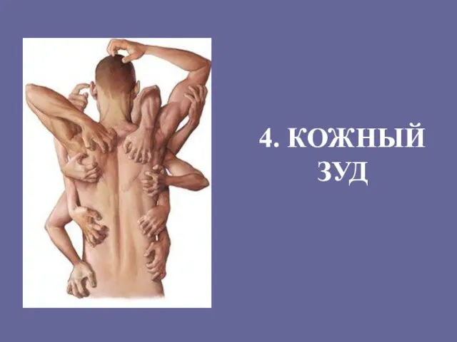 4. КОЖНЫЙ ЗУД