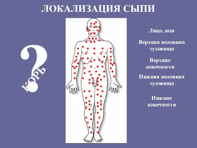 ЛОКАЛИЗАЦИЯ СЫПИ Верхние конечности Нижние конечности Нижняя половина туловища Лицо, шея ? КОРЬ Верхняя половина туловища