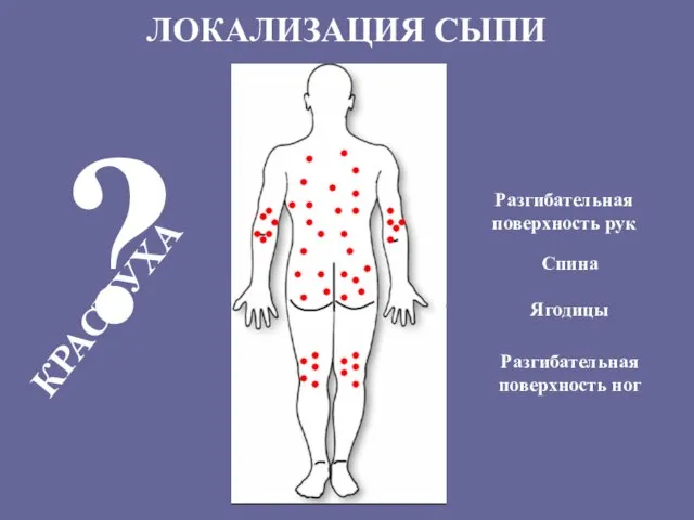 ЛОКАЛИЗАЦИЯ СЫПИ Разгибательная поверхность рук Разгибательная поверхность ног Спина Ягодицы ? КРАСНУХА