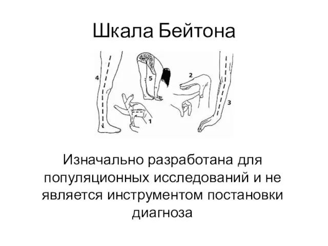 Шкала Бейтона Изначально разработана для популяционных исследований и не является инструментом постановки диагноза