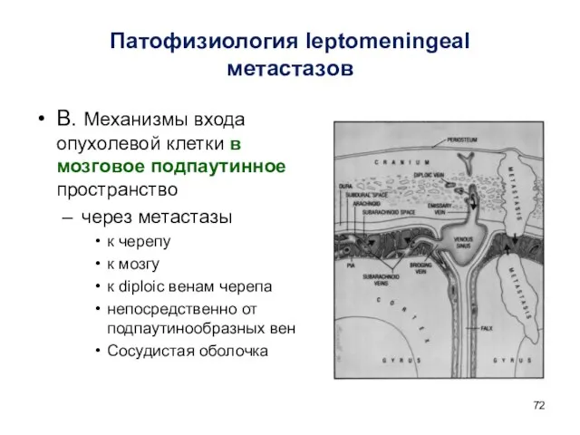 Патофизиология leptomeningeal метастазов В. Механизмы входа опухолевой клетки в мозговое подпаутинное