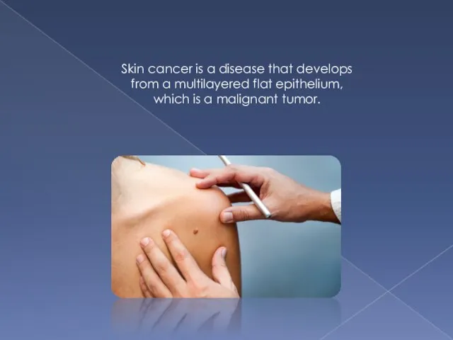 Skin cancer is a disease that develops from a multilayered flat