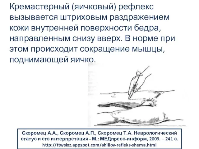 Кремастерный (яичковый) рефлекс вызывается штриховым раздражением кожи внутренней поверхности бедра, направленным